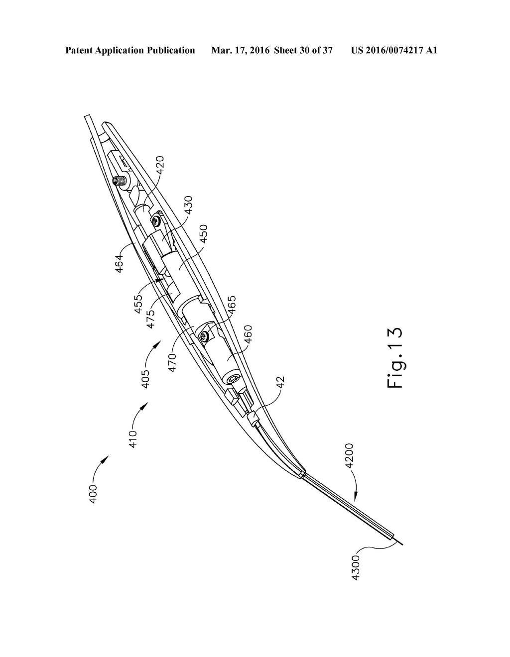 MOTORIZED SUPRACHOROIDAL INJECTION OF THERAPEUTIC AGENT - diagram, schematic, and image 31