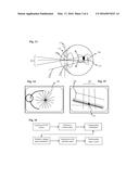 FEMTOSECOND LASER APPARATUS FOR PLASMA INDUCED VITREOUS ABLATION IN THE     EYE diagram and image