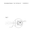 FEMTOSECOND LASER APPARATUS FOR PLASMA INDUCED VITREOUS ABLATION IN THE     EYE diagram and image