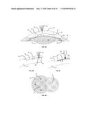 LASER APPARATUS AND METHOD FOR REFRACTIVE SURGERY diagram and image