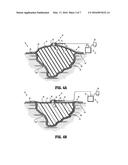 SHEAR RESISTANT WOUND DRESSING FOR USE IN VACUUM WOUND THERAPY diagram and image