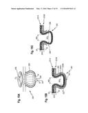 ABSORBENT ARTICLE COMPRISING A TOPSHEET/ACQUISITION LAYER LAMINATE diagram and image