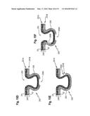 ABSORBENT ARTICLE COMPRISING A TOPSHEET/ACQUISITION LAYER LAMINATE diagram and image