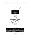 Absorbent Articles diagram and image