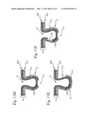 Absorbent Articles diagram and image