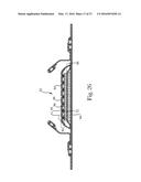 Absorbent Articles diagram and image