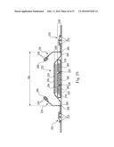 Absorbent Articles diagram and image