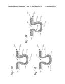 Nonwoven Material Having Discrete Three-Dimensional Deformations With Wide     Base Openings diagram and image