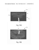 Nonwoven Material Having Discrete Three-Dimensional Deformations With Wide     Base Openings diagram and image