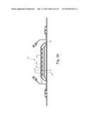 Nonwoven Material Having Discrete Three-Dimensional Deformations With Wide     Base Openings diagram and image