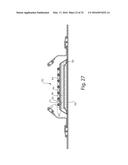 Nonwoven Material Having Discrete Three-Dimensional Deformations With Wide     Base Openings diagram and image