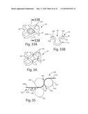 Nonwoven Material Having Discrete Three-Dimensional Deformations With Wide     Base Openings diagram and image