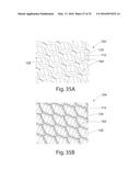 Nonwoven Material Having Discrete Three-Dimensional Deformations With Wide     Base Openings diagram and image