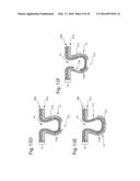 Nonwoven Material Having Discrete Three-Dimensional Deformations Forming     Protrusions Having A Varying Width And Wide Base Openings diagram and image