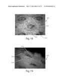 Nonwoven Material Having Discrete Three-Dimensional Deformations Forming     Protrusions Having A Varying Width And Wide Base Openings diagram and image