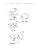 Nonwoven Material Having Discrete Three-Dimensional Deformations Forming     Protrusions Having A Varying Width And Wide Base Openings diagram and image