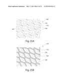 Nonwoven Material Having Discrete Three-Dimensional Deformations Forming     Protrusions Having A Varying Width And Wide Base Openings diagram and image