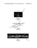 Absorbent Articles diagram and image