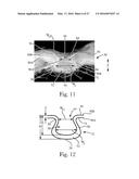 Absorbent Articles diagram and image