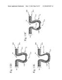 Absorbent Articles diagram and image