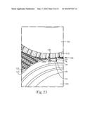 Absorbent Articles diagram and image