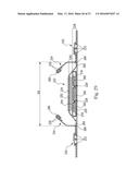 Absorbent Articles diagram and image