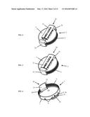 Closure Locking Assembly diagram and image