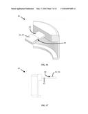 Closure Locking Assembly diagram and image