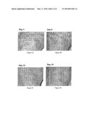 Histidine and/or Histidine Derivative for the Treatment of Inflammatory     Skin Diseases diagram and image