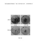 LLP2A-BISPHOSPHONATE CONJUGATES FOR OSTEOPOROSIS TREATMENT diagram and image