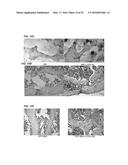 LLP2A-BISPHOSPHONATE CONJUGATES FOR OSTEOPOROSIS TREATMENT diagram and image