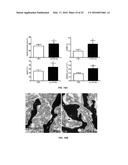 LLP2A-BISPHOSPHONATE CONJUGATES FOR OSTEOPOROSIS TREATMENT diagram and image