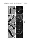 LLP2A-BISPHOSPHONATE CONJUGATES FOR OSTEOPOROSIS TREATMENT diagram and image