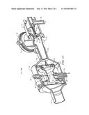 Bi-level Positive Airway Pressure Device diagram and image