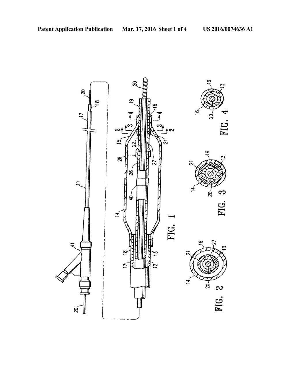 CATHETER HAVING TRANSITIONING SHAFT SEGMENTS - diagram, schematic, and image 02