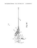 PRESSURE RELIEF FOR A CATHETER BALLOON DEVICE diagram and image