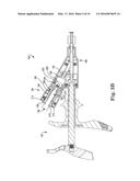 PRESSURE RELIEF FOR A CATHETER BALLOON DEVICE diagram and image