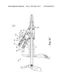 PRESSURE RELIEF FOR A CATHETER BALLOON DEVICE diagram and image