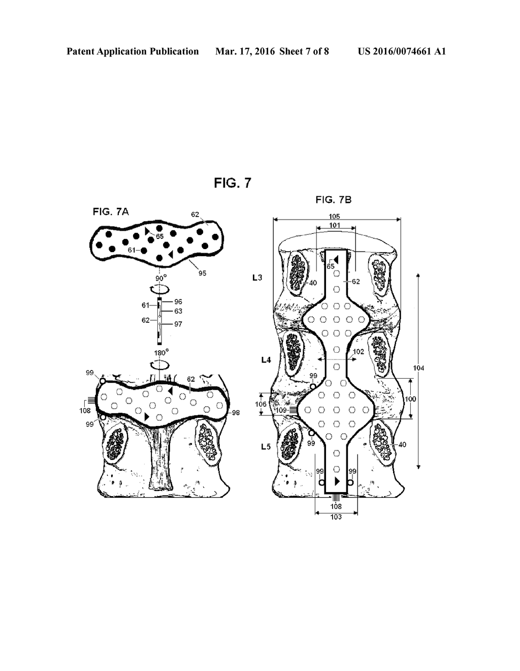 System and Methods for Diagnosis and Treatment of Discogenic Lower Back     Pain - diagram, schematic, and image 08