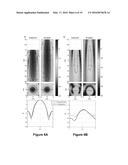 PLANNING SYSTEM FOR TARGETING TISSUE STRUCTURES WITH ULTRASOUND diagram and image