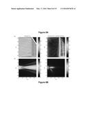 PLANNING SYSTEM FOR TARGETING TISSUE STRUCTURES WITH ULTRASOUND diagram and image