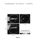 PLANNING SYSTEM FOR TARGETING TISSUE STRUCTURES WITH ULTRASOUND diagram and image