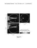 PLANNING SYSTEM FOR TARGETING TISSUE STRUCTURES WITH ULTRASOUND diagram and image