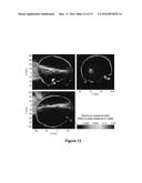 PLANNING SYSTEM FOR TARGETING TISSUE STRUCTURES WITH ULTRASOUND diagram and image