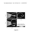 PLANNING SYSTEM FOR TARGETING TISSUE STRUCTURES WITH ULTRASOUND diagram and image