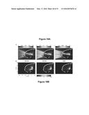 PLANNING SYSTEM FOR TARGETING TISSUE STRUCTURES WITH ULTRASOUND diagram and image