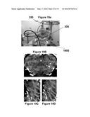 PLANNING SYSTEM FOR TARGETING TISSUE STRUCTURES WITH ULTRASOUND diagram and image