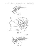 GOLF CLUB HAVING REMOVABLE WEIGHT diagram and image