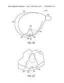 GOLF CLUB HAVING REMOVABLE WEIGHT diagram and image