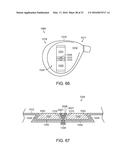 GOLF CLUB HAVING REMOVABLE WEIGHT diagram and image